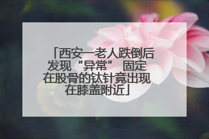西安一老人跌倒后发现“异常” 固定在股骨的钛针竟出现在膝盖附近