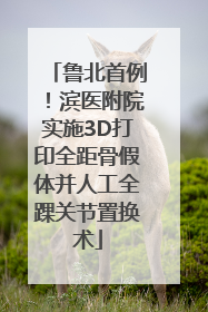 鲁北首例！滨医附院实施3D打印全距骨假体并人工全踝关节置换术